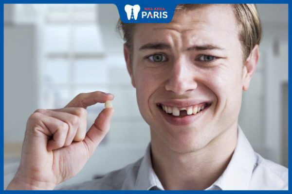 Trồng răng cửa bị gãy: Giải pháp và quy trình điều trị hiệu quả