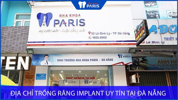 Địa chỉ trồng răng Implant uy tín tại Đà Nẵng