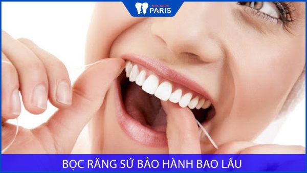 Bọc răng sứ bảo hành bao lâu? Chế độ bảo hành ra sao