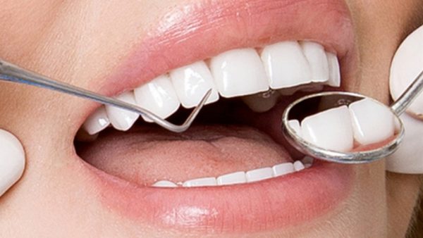Bọc răng sứ mất bao lâu? Nhanh nhất thì mất Mấy Ngày?