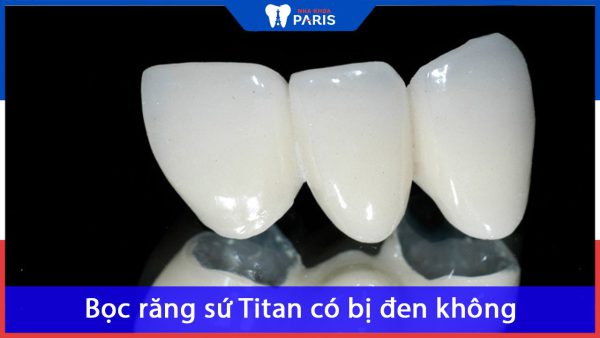 Bọc răng sứ Titan có bị đen không? Cách xử lý