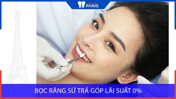 Bọc răng sứ Trả Góp lãi suất 0% tại Nha Khoa Paris