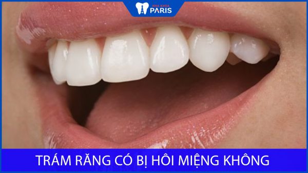 Trám răng có bị hôi miệng không? Nha khoa paris