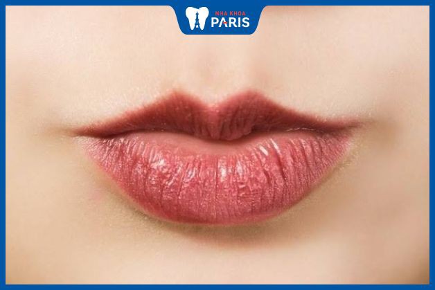 6 cách trang điểm hô biến đôi môi trông căng mọng hơn mà không cần phải  tiêm filler, Đẹp, aFamily, fast News