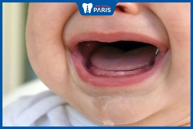 Tại sao trẻ mọc răng lại bị tiêu chảy