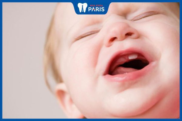 Trẻ mọc răng có bị tiêu chảy không? Nguyên nhân, cách điều trị