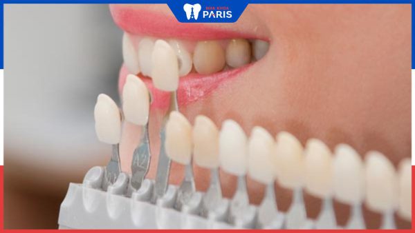 Bọc răng sứ có hại không? Những lưu ý khi bọc răng sứ