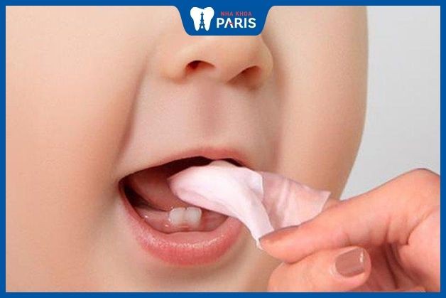 Cha mẹ cần vệ sinh răng, nướu cho bé cẩn thận để tránh nướu nhiễm khuẩn khi mọc răng