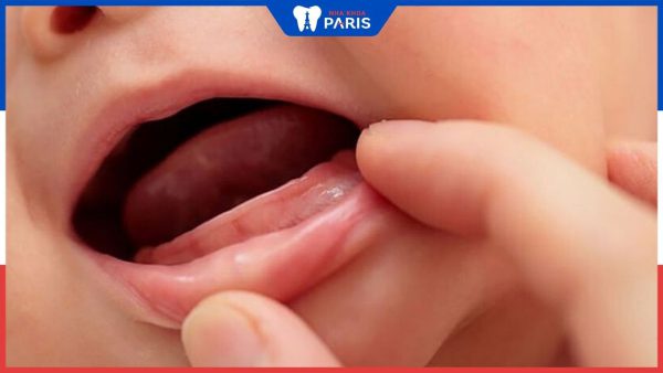 Trẻ 7 tháng chưa mọc răng: Có đáng lo ngại?