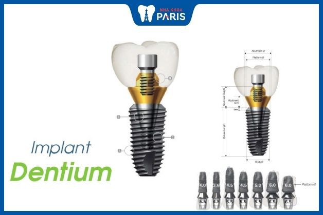 Trụ Implant Dentium có khả năng tương thích sinh học với xương hàm cao