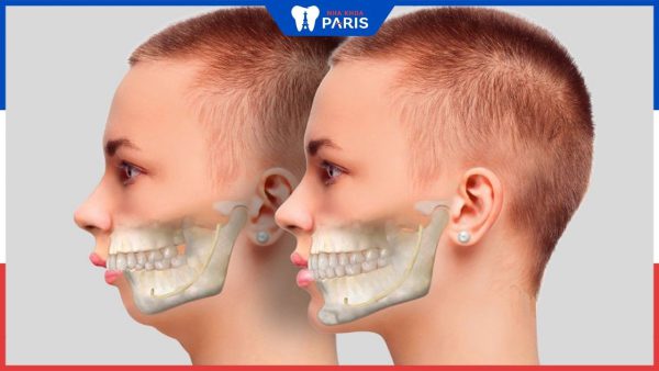 Nha Khoa Paris – Địa chỉ phẫu thuật hàm mặt Top 1 Đà Nẵng