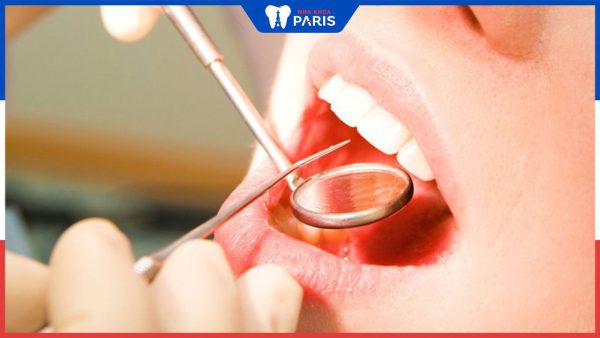 Lấy cao răng có bị HIV không? Cách phòng tránh lây nhiễm
