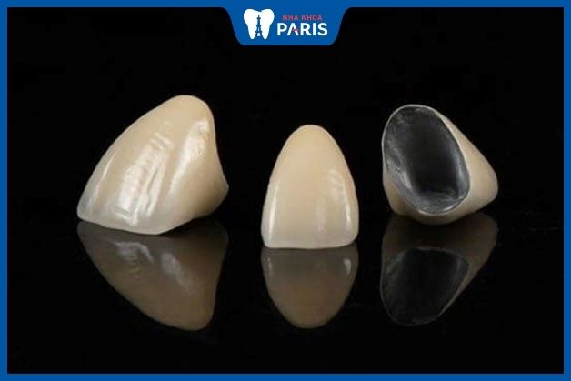 Sườn răng sứ Inox được làm bằng hợp kim kim loại