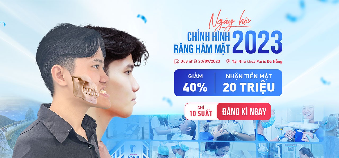 Nha khoa Paris Đà Nẵng – Chỉnh hình hàm mặt chuẩn bệnh viện