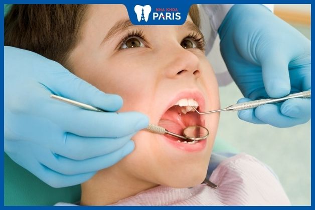 Điều trị sâu răng số 6 ở trẻ em