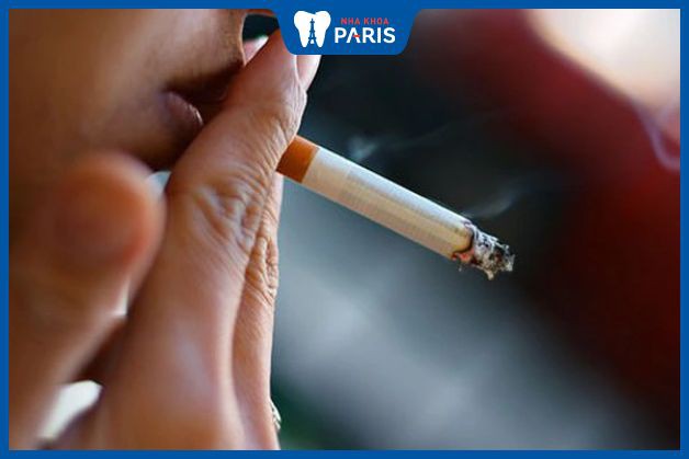 Hút thuốc lá làm tăng nguy cơ u răng