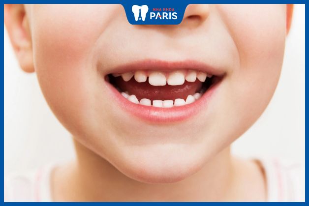 Xịt chống sâu răng giúp bảo vệ men răng của trẻ