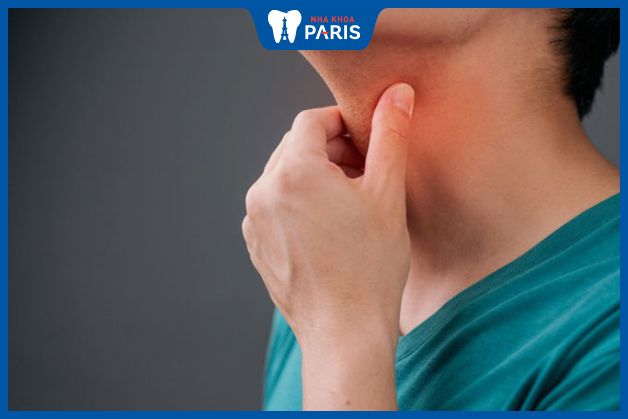Đau họng là triệu chứng đầu tiên của viêm họng mãn tính