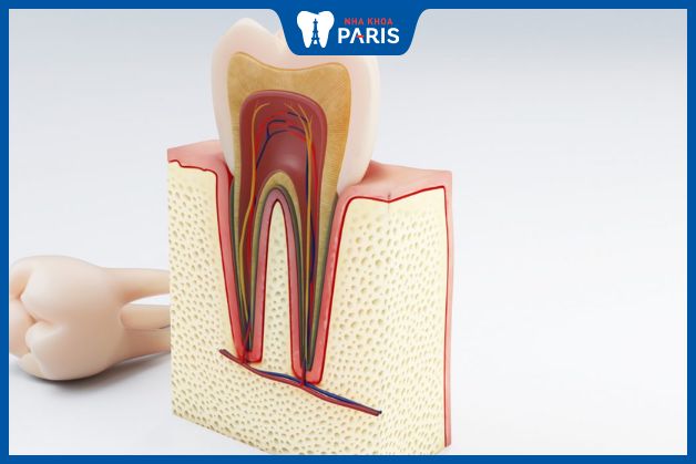 Hàn ống tủy sớm đảm bảo chức năng của răng