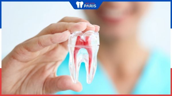 Khi nào cần điều trị tủy răng: Nha Khoa Paris giải đáp