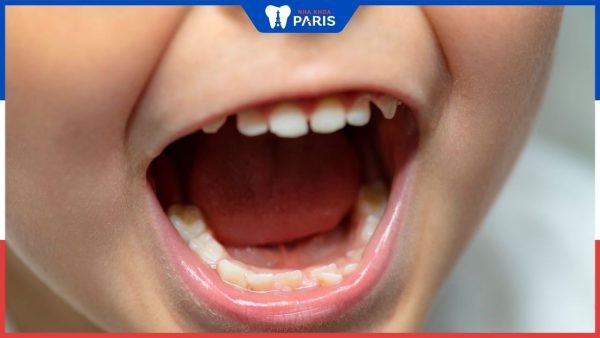 Trẻ 5 tuổi mọc răng hàm: Dấu hiệu và cách chăm sóc