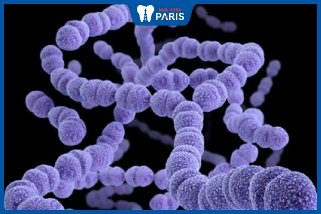 Liên cầu khuẩn nhóm A Streptococcus gây viêm họng cấp