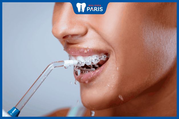 Máy tăm nước giúp làm sạch răng miệng và ngăn ngừa viêm nướu