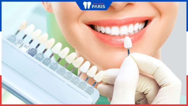 Bọc răng nhựa giá bao nhiêu? Yếu tố ảnh hưởng đến chi phí