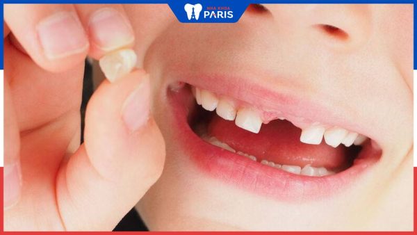 Khi nào nhổ răng sữa cho trẻ là tốt nhất? Phương pháp nhổ răng sữa