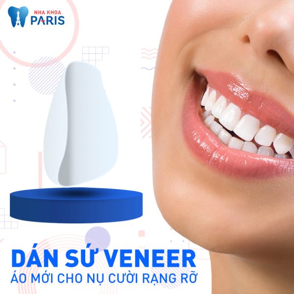 Mặt dán sứ Veneer – Sự lựa chọn tối ưu cho hàm răng khỏe đẹp