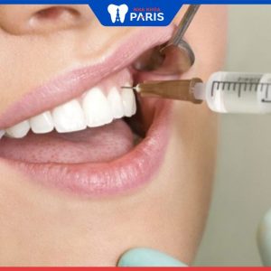 Tiêm thuốc tê nhổ răng có đau không? Lưu ý sau khi tiêm thuốc tê