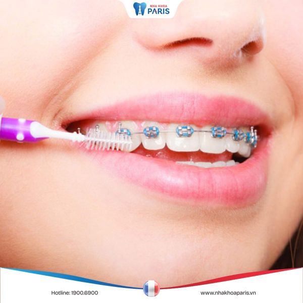 Bàn chải kẽ răng: Bí quyết cho hàm răng trắng sáng và khỏe mạnh