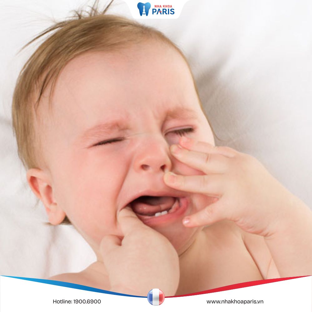 Trẻ sốt mọc răng hàm: Nguyên nhân, dấu hiệu và cách xử lý