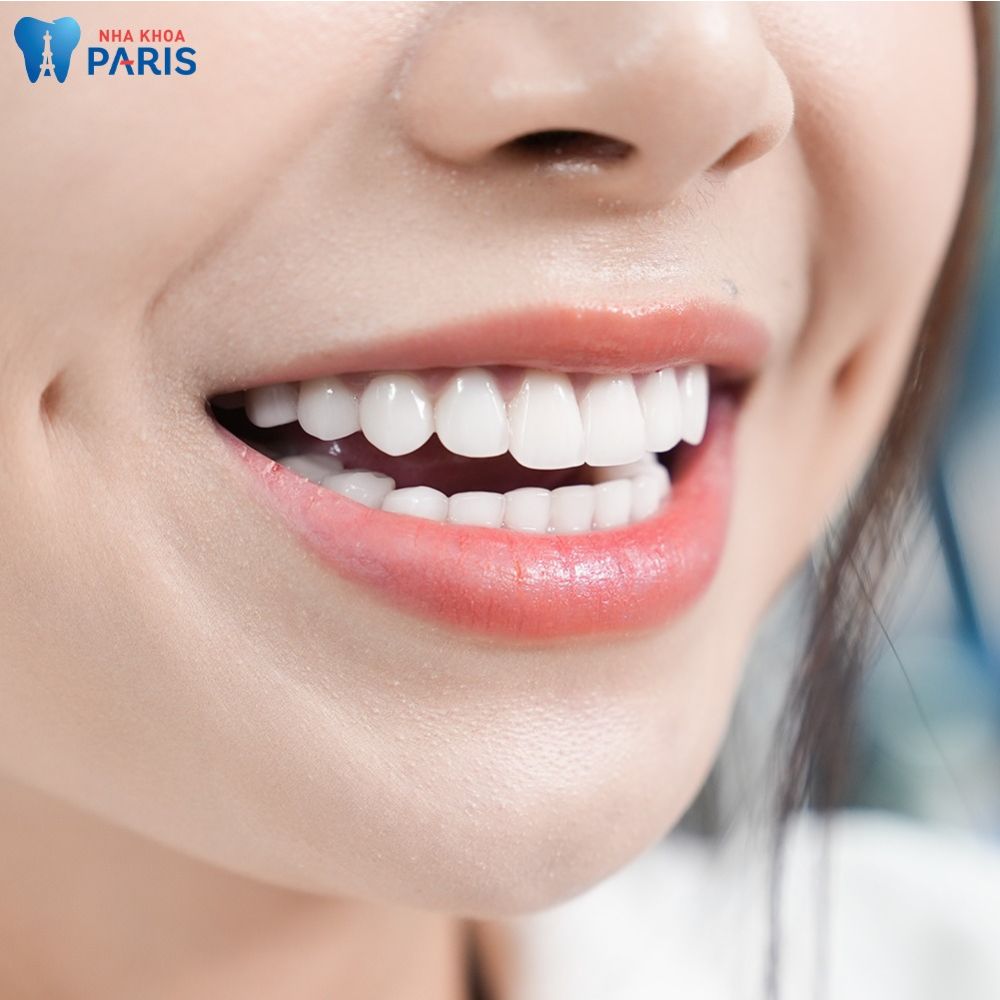 Răng sứ có màu sắc tự nhiên như răng thật