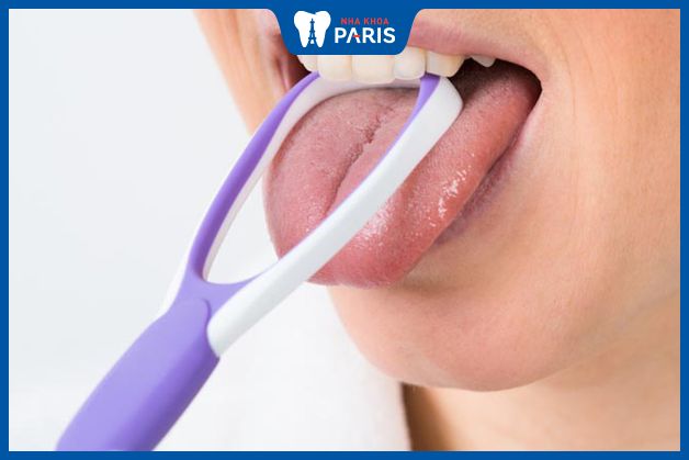 Cạo lưỡi giúp loại bỏ vi khuẩn gây hôi miệng