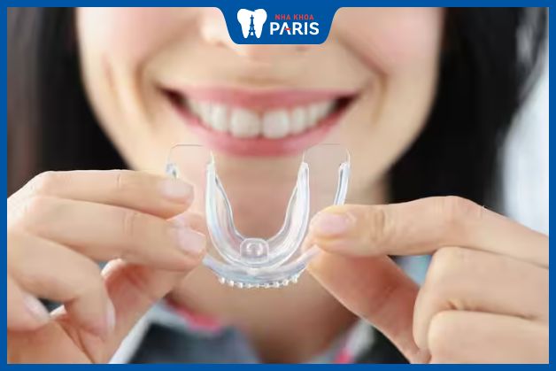 Máng chống nghiến răng góp phần ngăn ngừa các bệnh răng miệng