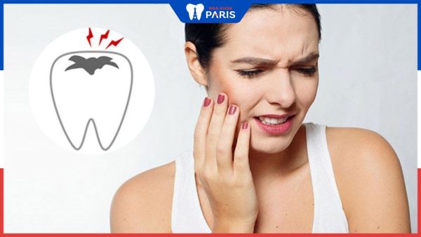 8 Cách trị đau răng sâu tại nhà an toàn và dứt điểm