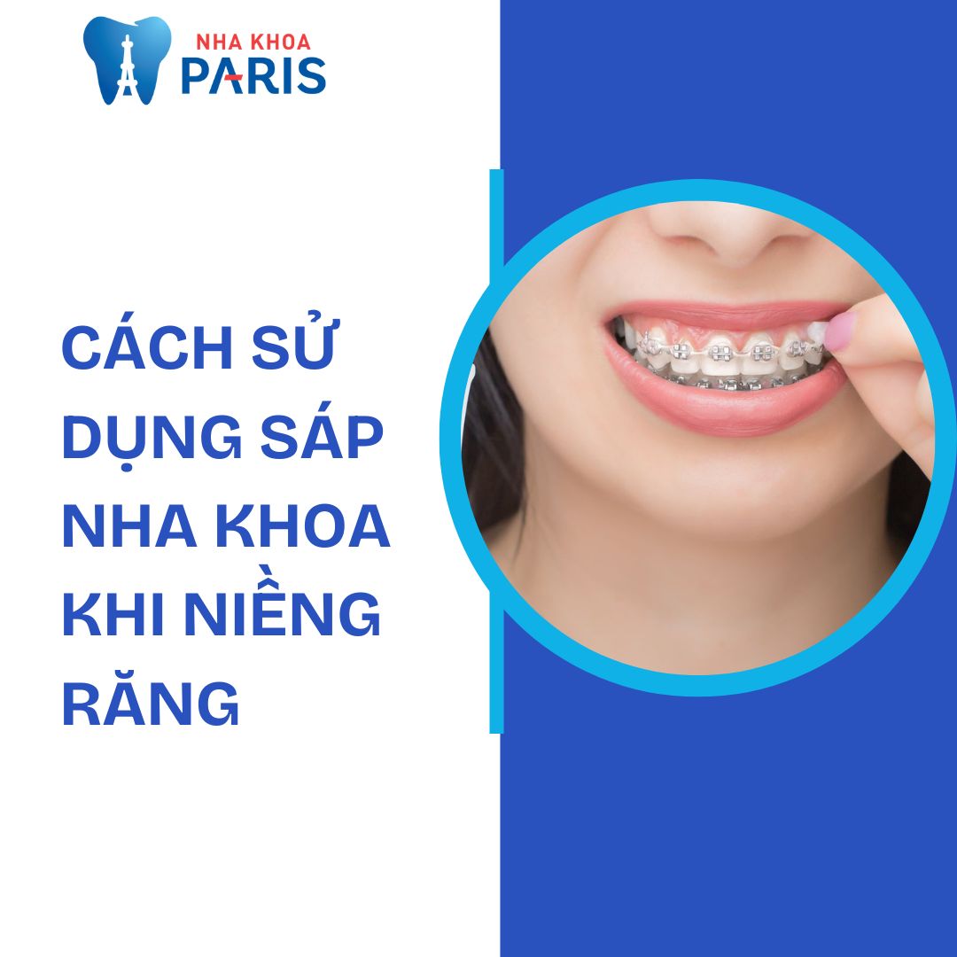 Cách xài sáp nha khoa đúng cách giúp giảm đau hiệu quả