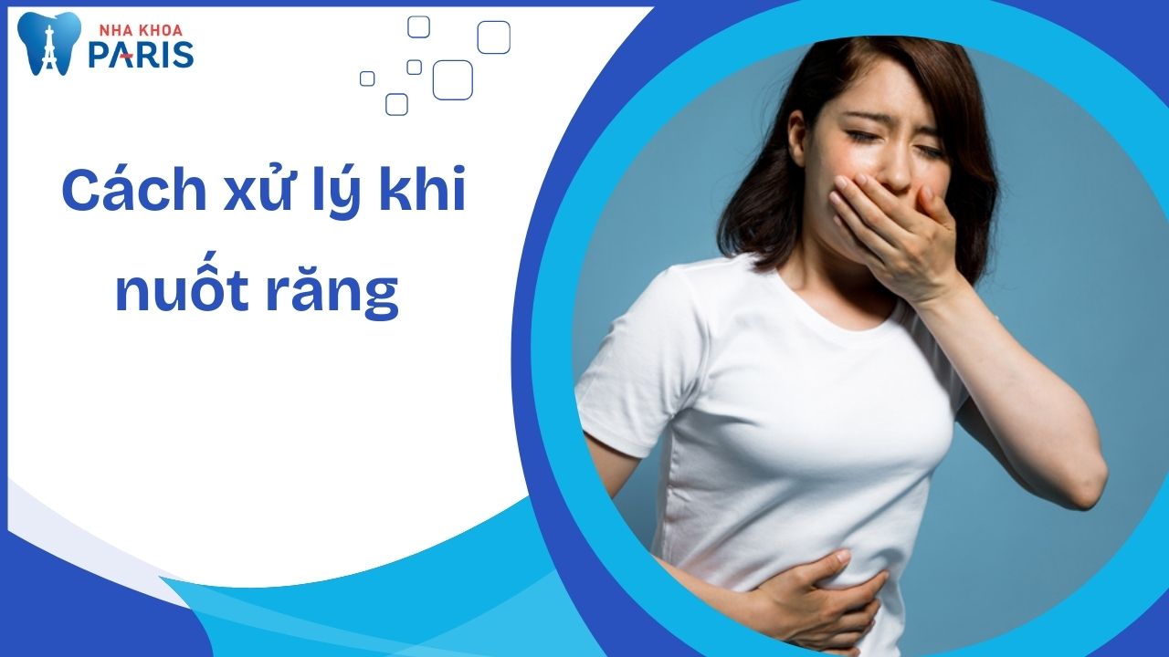 Cách xử lý khi nuốt răng đúng cách, ngăn biến chứng nguy hiểm