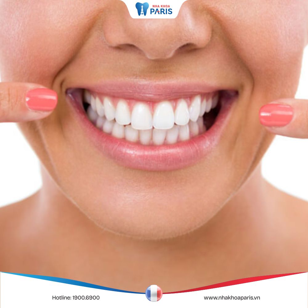 Cảm giác sau khi bọc răng sứ: Trải nghiệm thực tế từ khách hàng