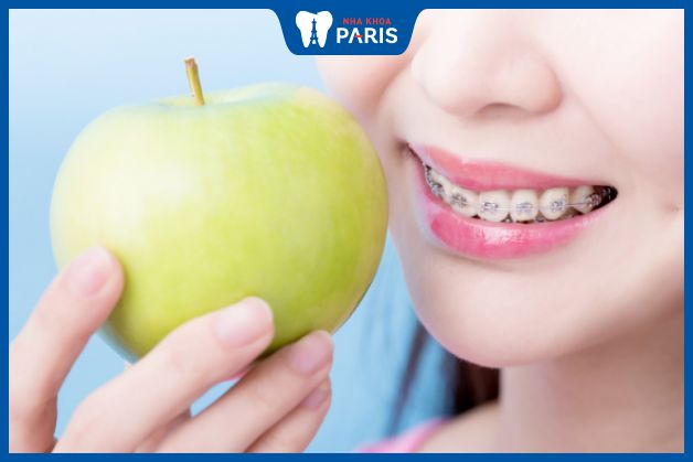 Chế độ ăn uống ảnh hưởng đến hiệu quả và thời gian niềng răng