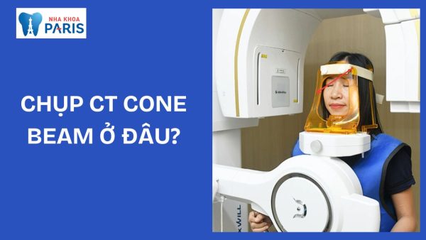 Chụp CT conebeam là gì? Chụp như thế nào? Cần chuẩn bị gì không?