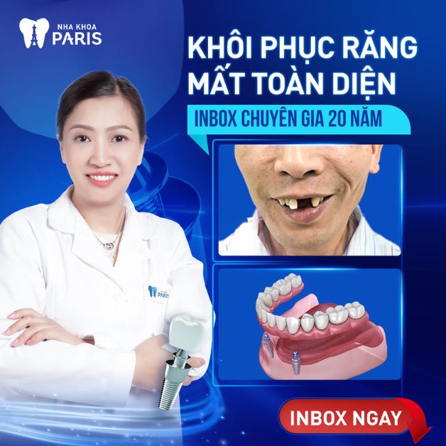 Nha khoa Paris - địa chỉ phục hình răng bị gãy uy tín