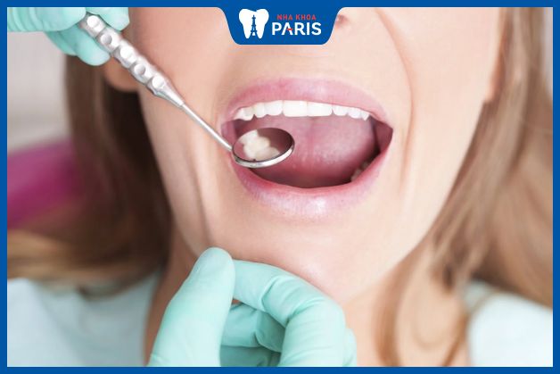 Khám răng định kỳ giúp phát hiên sớm các bệnh lý như sâu răng, viêm nướu