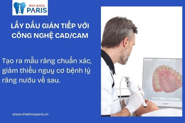 Công nghệ lấy dấu răng CAD/CAM hiện đại nhất hiện nay