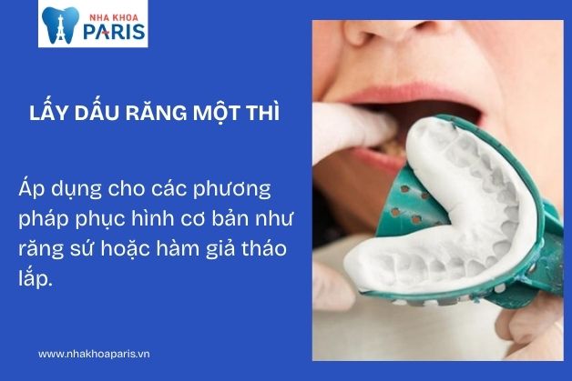 Lấy dấu răng 1 thì là kỹ thuật chỉ cần sử dụng một loại vật liệu duy nhất