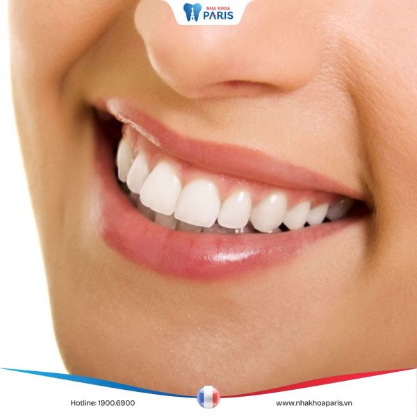 26 cái răng là bao nhiêu? Ảnh hưởng & Cách khắc phục thiếu răng