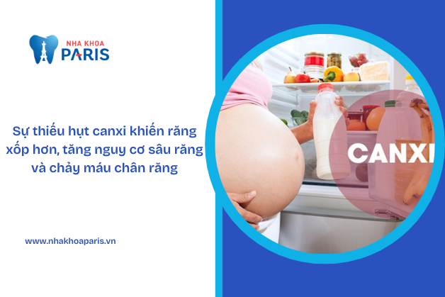 Thiếu canxi là một trong những nguyên nhân gây ra chảy máu chân răng ở bà bầu