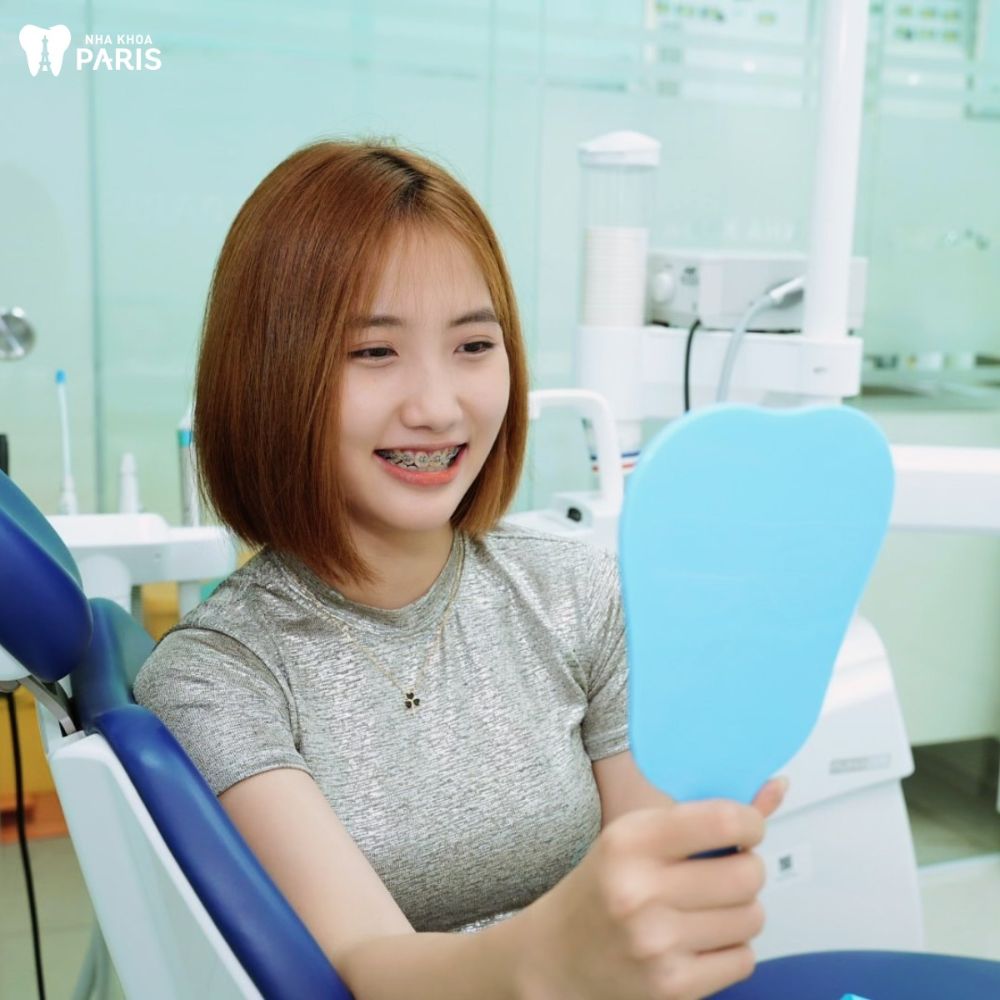 Niềng răng giá tốt với chất lượng quốc tế tại Nha khoa Paris