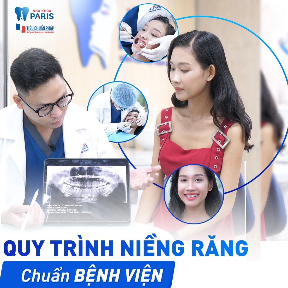 Quy trình niềng tại Nha Khoa Paris chuẩn bệnh viện